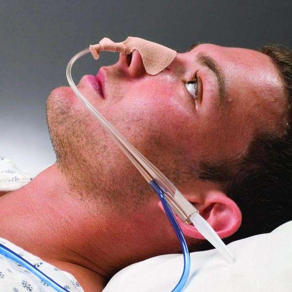 Feeding Tube Insertion